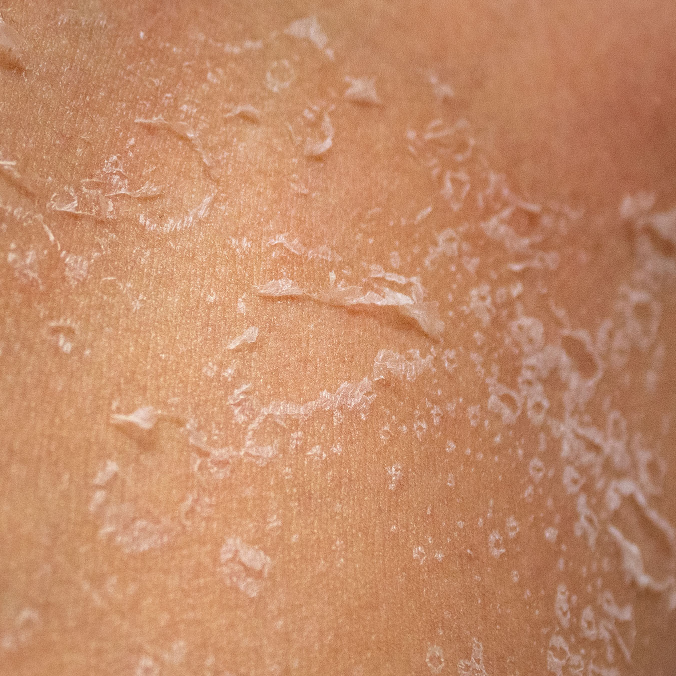 Gentle Exfoliating Complex